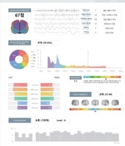 천안 공황장애 자율신경검사