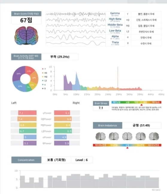 불면증 자율신경검사 HRV
