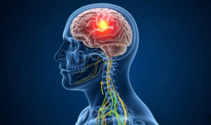 천안 두통 MRI 검사
