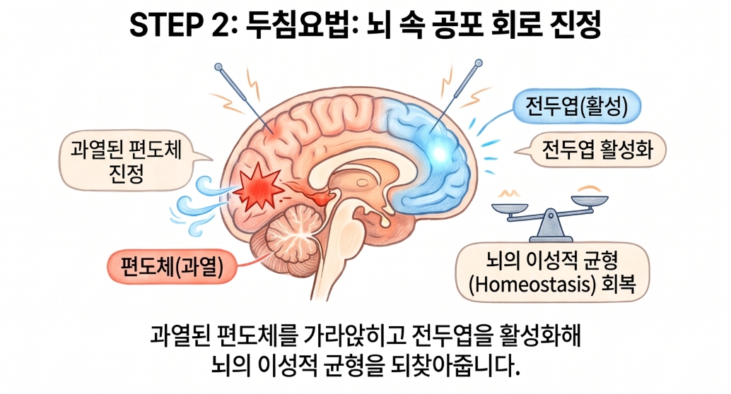 더예그린한의원 두통 두침요법